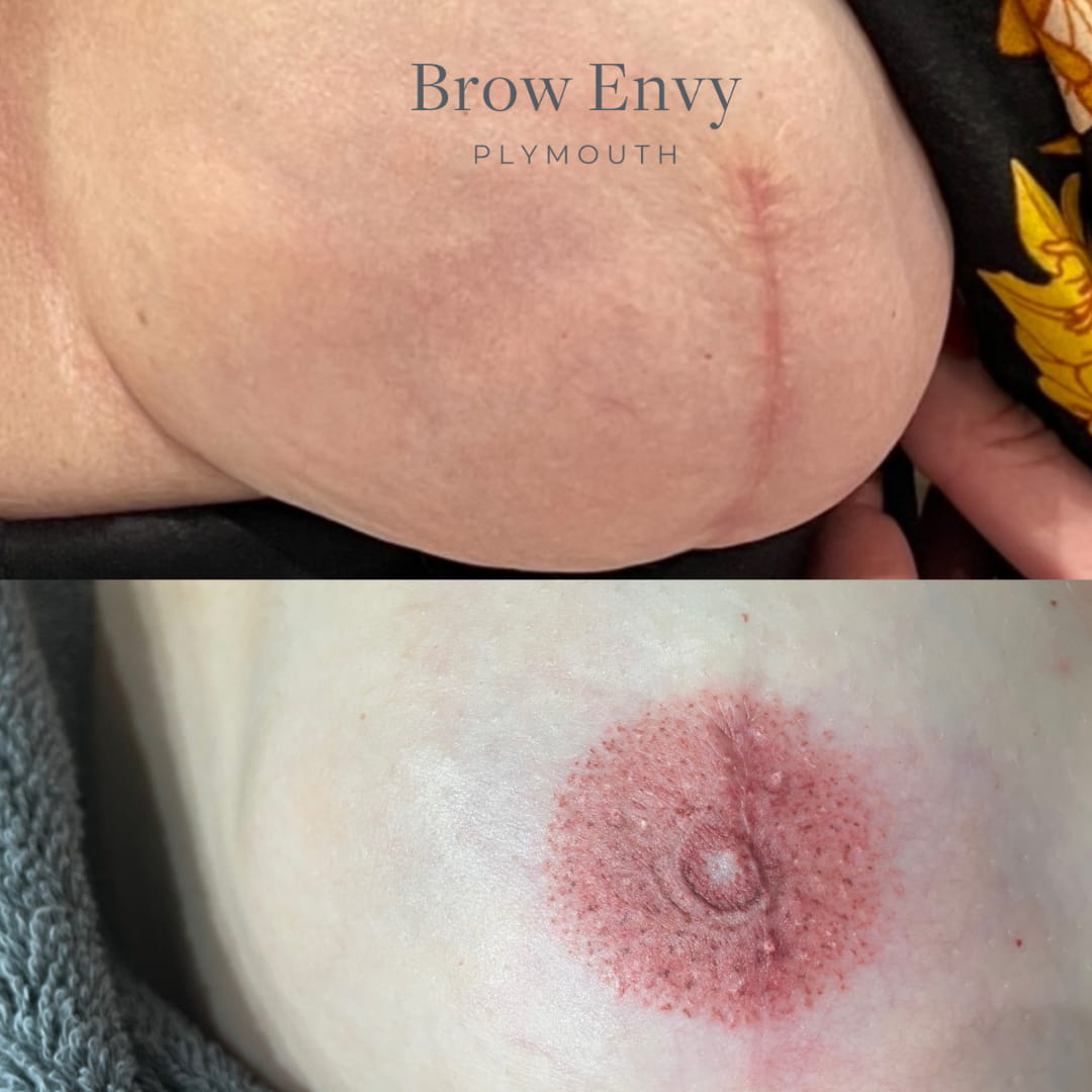 Nipple Tattoos - Medical Areola Tattoos - Brow Envy
