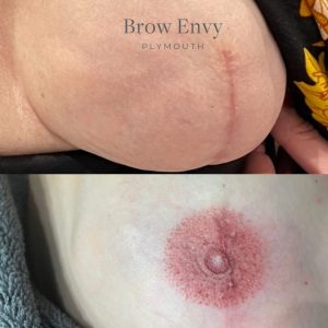 Areola nipple tattoing