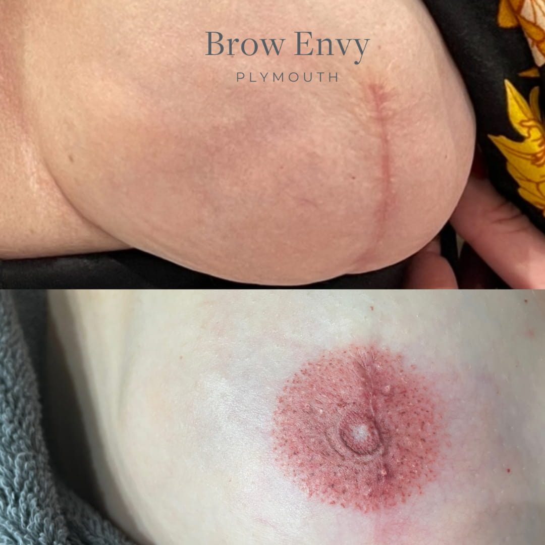 Areola nipple tattoing